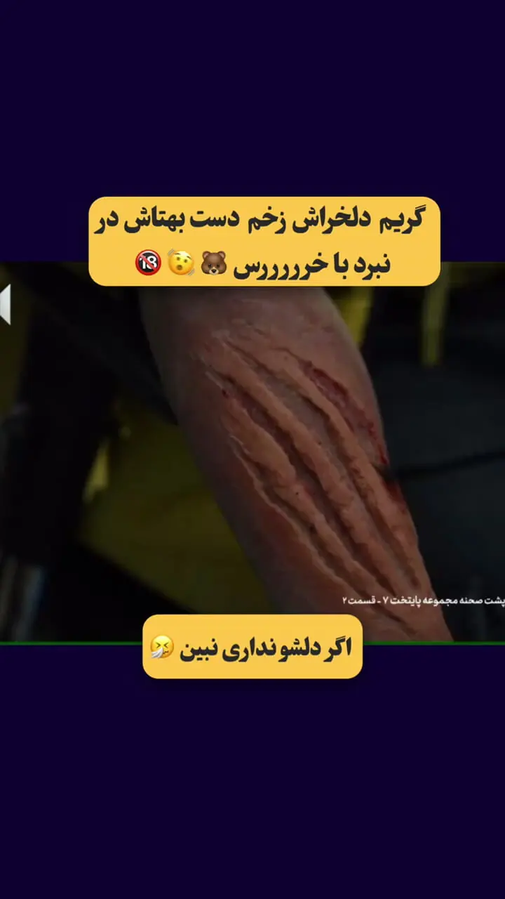 مراحل گریم دلخراش دستِ بهتاش در مبارزه با خرس